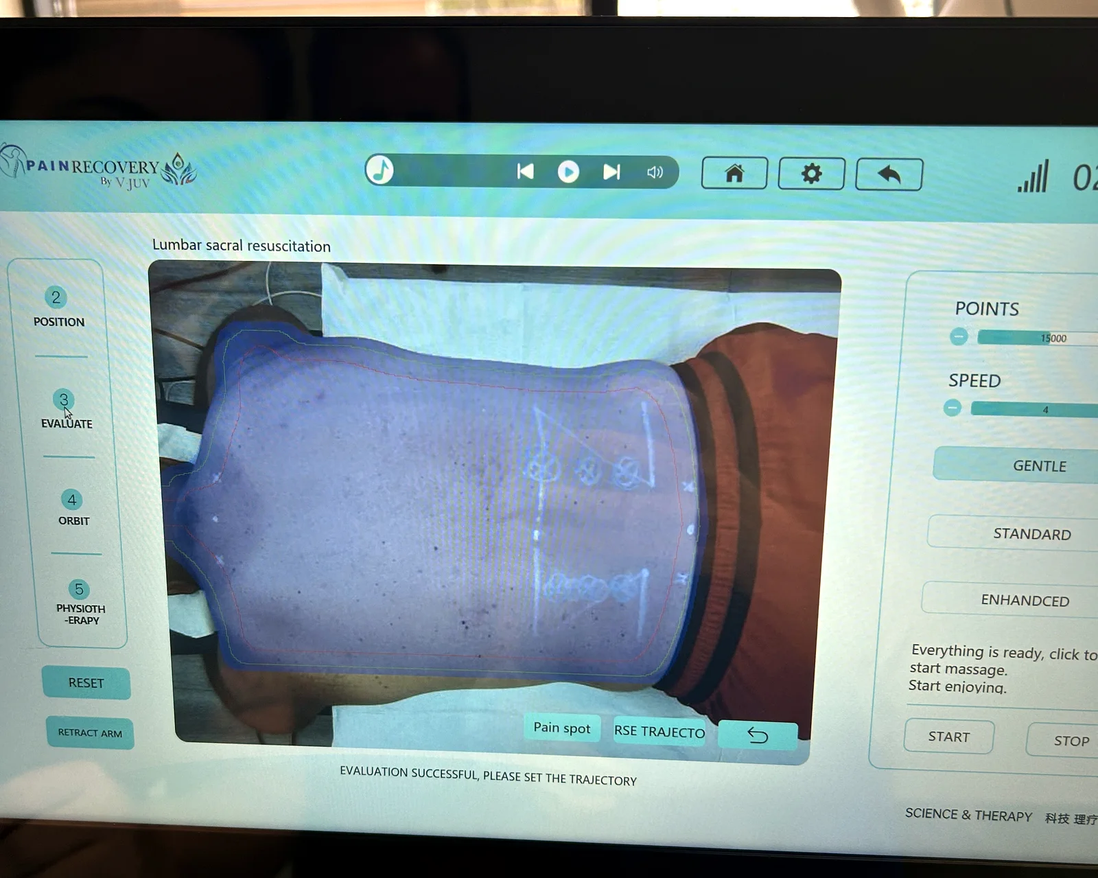 The PainRecovery robotic shockwave control interface, mapping treatment points on a real session